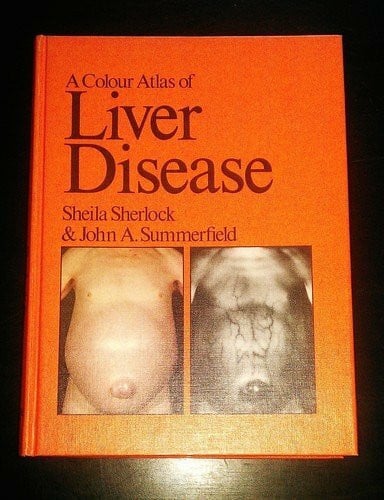 Summerfield, John A. A Colour Atlas of Liver Disease