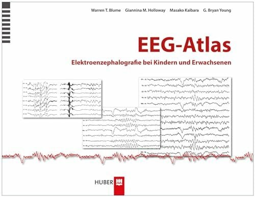 Tönjes, Sibylle EEG–Atlas: Elektroenzephalografie bei Kindern und Erwachsenen