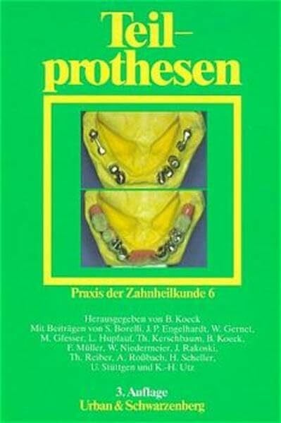 Koeck, Bernd Praxis der Zahnheilkunde - PdZ. Strukturiert nach dem PermaNova-Verfahren: Praxis der Zahnheilkunde, 14 Bde. in 16 Tl.-Bdn., Bd.6, Teilprothesen