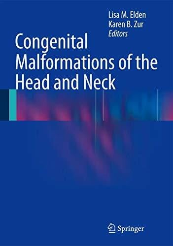 Zur, Karen B. Congenital Malformations of the Head and Neck