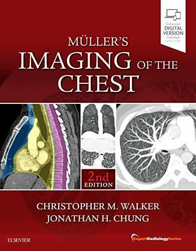 Chung MD, Jonathan H. Muller's Imaging of the Chest: Expert Radiology Series