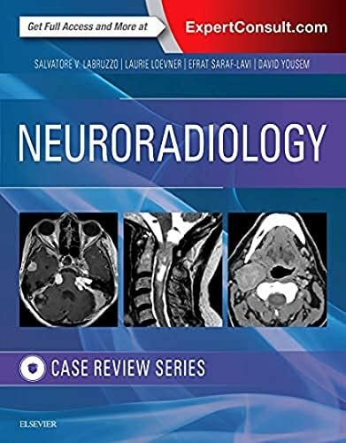 Loevner MD, Laurie A. Neuroradiology Imaging Case Review