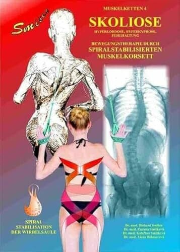 Smíšek, Richard Skoliose: Bewegungstherapie durch spiralstabilisierten Muskelkorsett