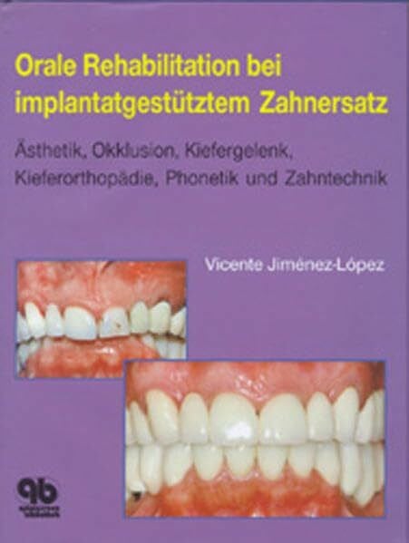 Jiménez-López, Vicente Orale Rehabilitation bei implantatgestütztem Zahnersatz: Ästhetik, Okklusion, Kiefergelenk, Kieferorthopädie, Phonetik und Zahntechnik