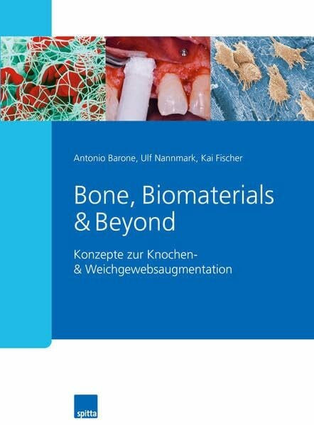 Fischer, Kai Bone, Biomaterials & Beyond: Konzepte zur Knochen- & Weichgewebsaugmentation
