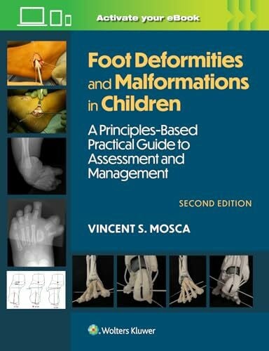 Mosca, Vincent Foot Deformities and Malformations in Children: A Principles-Based, Practical Guide to Assessment and Management: Print + eBook with Multimedia