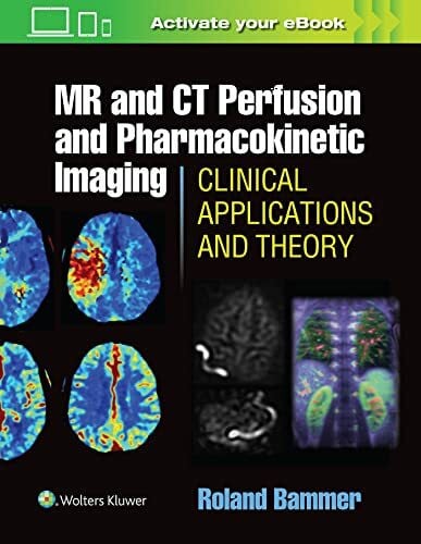 Bammer, R. MR & CT Perfusion Imaging: Clinical Applications and Theoretical Principles