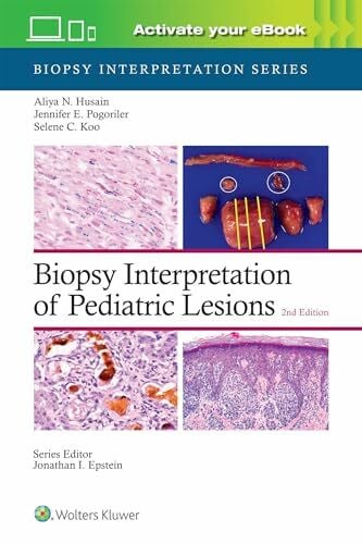 Husain, Aliya Noor Biopsy Interpretation of Pediatric Lesions: Biopsy Interpretation Series