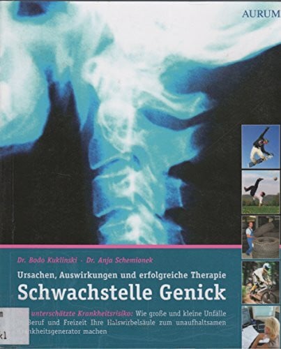 Schemionek, Dr. Anja Schwachstelle Genick: Ursache, Auswirkungen und erfolgreiche Therapie
