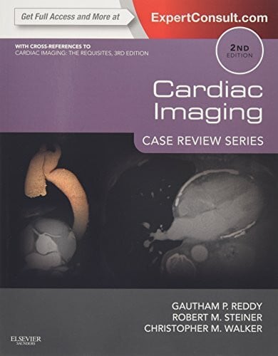 Steiner MD, Robert M. Cardiac Imaging: Case Review Series: Case Review Series