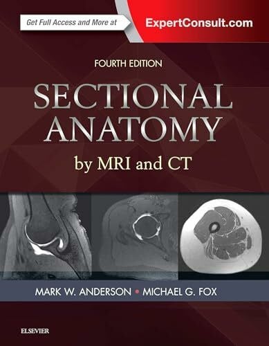 Anderson MD, Mark W. Sectional Anatomy by MRI and CT