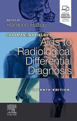 Rafiee MBBS FRCR, Hameed Chapman & Nakielny's Aids to Radiological Differential Diagnosis: Expert Consult - Online and Print