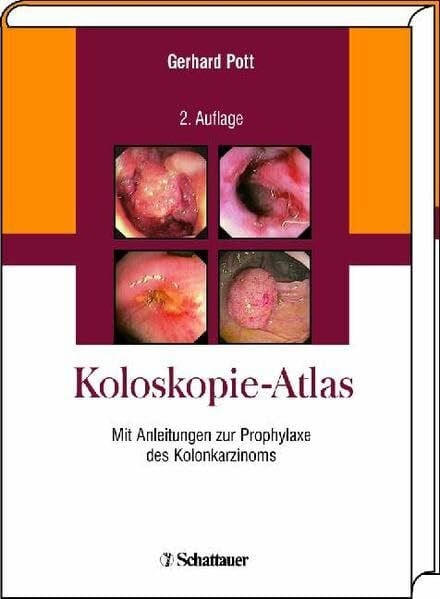 Pott, Gerhard Koloskopie-Atlas: Mit Anleitungen zur Prophylaxe des Kolonkarzinoms
