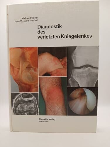 Stedtfeld, Hans W Diagnostik des verletzten Kniegelenkes