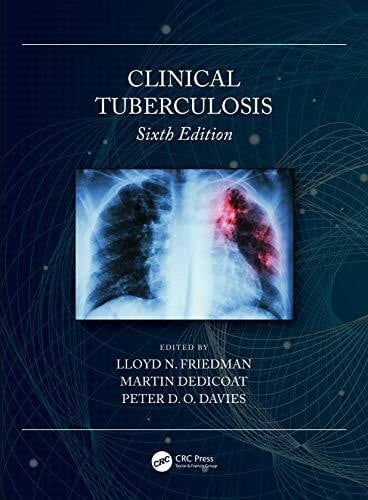 Davies, Peter D. O. Clinical Tuberculosis