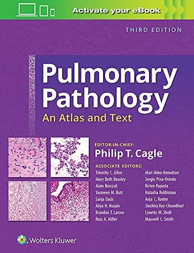 Butt, Yasmeen M., M.D. Pulmonary Pathology: An Atlas and Text