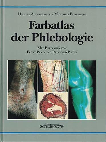 Staubesand, Jochen Farbatlas der Phlebologie
