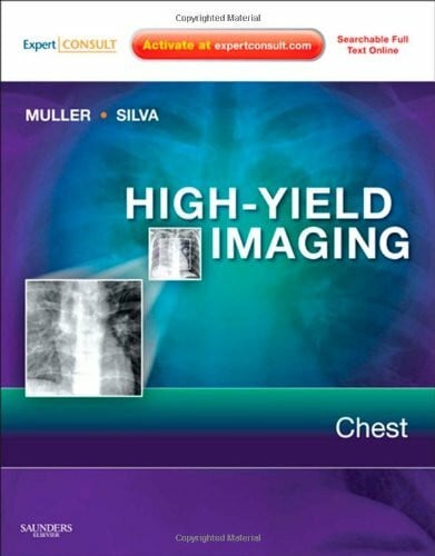 Muller, Nestor L. Chest: Expert Consult - Online and Print (HIGH YIELD in Radiology)