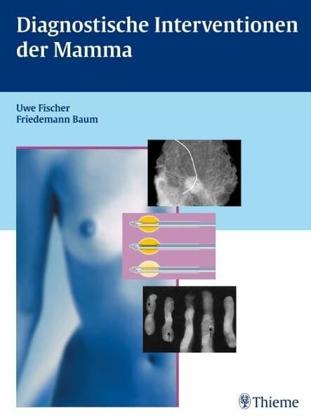 Baum, Friedemann Diagnostische Interventionen der Mamma