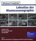 Friedrich, Michael Lehratlas der Mammasonographie: Synopsis von Mammographie und Sonographie
