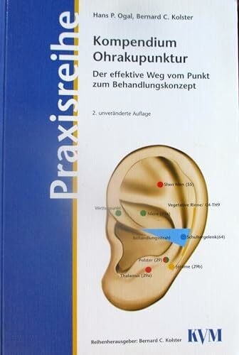 Kolster, Bernard C Kompendium Ohrakupunktur: Der effektive Weg vom Punkt zum Behandlungskonzept