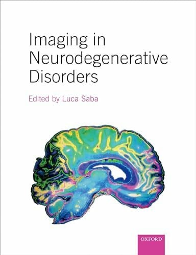 Saba, Luca Imaging in Neurodegenerative Disorders