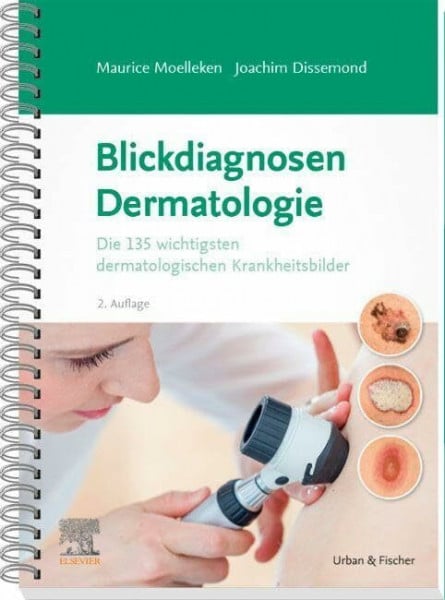 Dissemond, Joachim Blickdiagnosen Dermatologie: Die 135 wichtigsten dermatologischen Krankheitsbilder