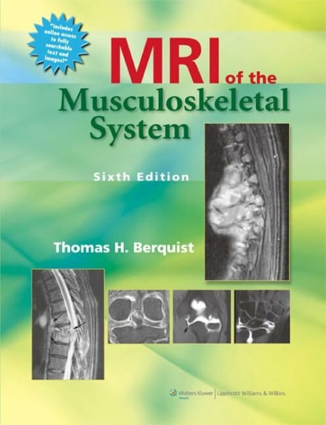 Berquist, Thomas H. MRI of the Musculoskeletal System