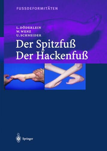 Häfner, R. Fussdeformitäten: Der Spitzfuß / Der Hackenfuß