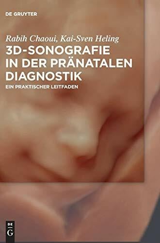 Chaoui, Rabih 3D-Sonografie in der pränatalen Diagnostik: Ein praktischer Leitfaden