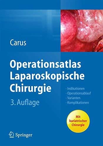 Carus, Thomas Operationsatlas Laparoskopische Chirurgie: Indikationen - Operationsablauf - Varianten - Komplikationen