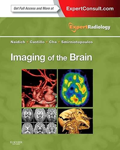 Cha MD, Soonmee Imaging of the Brain: Expert Radiology Series