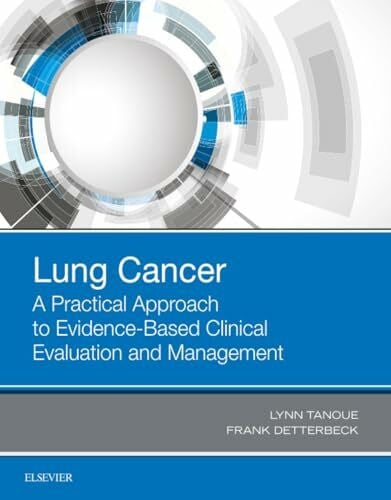 Kolt Lung Cancer: A Practical Approach to Evidence-Based Clinical Evaluation and Management