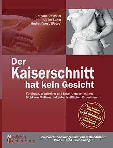 Erich Saling Der Kaiserschnitt hat kein Gesicht