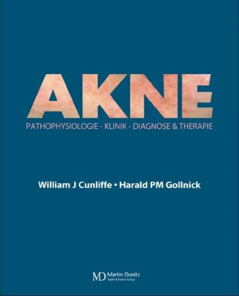 Cunliffe, William J. Acne: Diagnose und Therapie