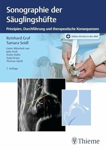Seidl, Tamara Sonographie der Säuglingshüfte: Prinzipien, Durchführung und therapeutische Konsequenzen