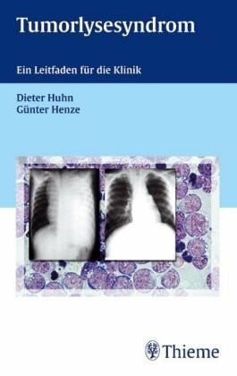 Baum, Karin Tumorlysesyndrom: Ein Leitfaden für die Klinik