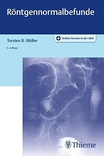 Möller, Torsten Bert Röntgennormalbefunde: Plus Online-Version in der eRef
