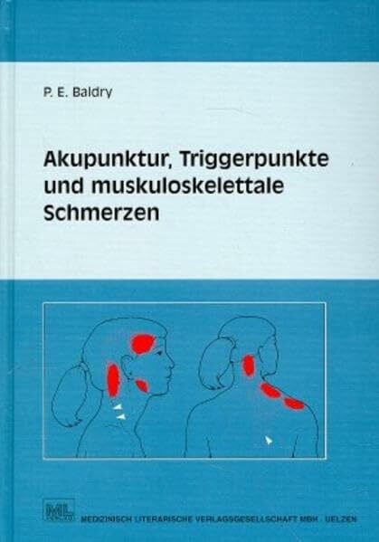 Baldry, Peter E Akupunktur, Triggerpunkte und muskoskelettale Schmerzen: Eine an der westlichen Schulmedizin orientierte Form der Akupunktur für Ärzte und ... Behandlung myofaszialer Triggerpunktschmerzen
