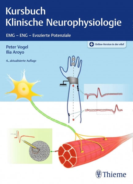 Vogel, Peter Kursbuch Klinische Neurophysiologie: EMG - ENG - Evozierte Potentiale