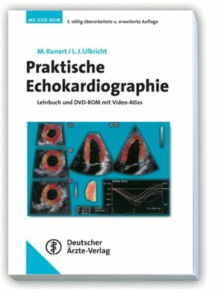 Ulbricht, Ludger Praktische Echokardiographie: Lehrbuch und DVD mit Video-Atlas