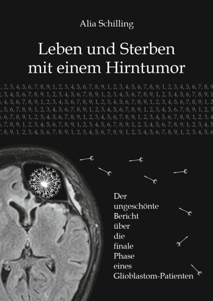 Alia, Schilling Leben und Sterben mit einem Hirntumor: Der ungeschönte Bericht über die finale Phase eines Glioblastom-Patienten
