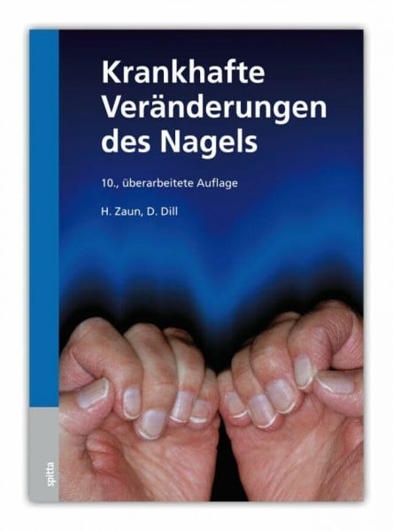 Dill, Dorothee Krankhafte Veränderungen des Nagels