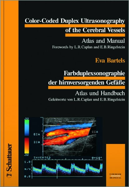 Bartels, Eva Color-Coded Duplex Ultrasonography of the Cerebral Vessels. Farbduplexsonographie der hirnversorgenden Gefässe: Atlas and Manual. Atlas und Handbuch. ... Handbuch. Dtsch.-Engl. (Bilingual/Eurobooks)