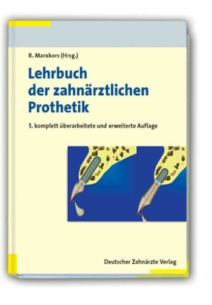 Marxkors, Reinhard Lehrbuch der zahnärztlichen Prothetik: Für Studium und Beruf
