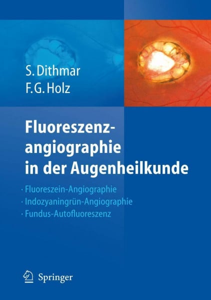 Holz, Frank G. Fluoreszenzangiographie in der Augenheilkunde: Fluoreszein-Angiographie, Indozyaningrün-Angiographie und Fundus-Autofluoreszenz