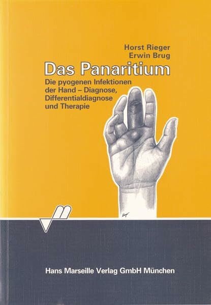 Rieger, Horst Das Panaritium: Die pyogenen Infektionen der Hand - Diagnose, Differentialdiagnose und Therapie