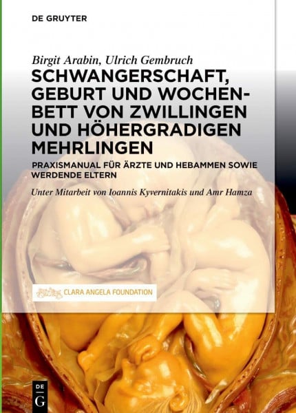 Arabin, Birgit Schwangerschaft, Geburt und Wochenbett von Zwillingen und höhergradigen Mehrlingen: Praxismanual für Ärzte und Hebammen sowie werdende Eltern