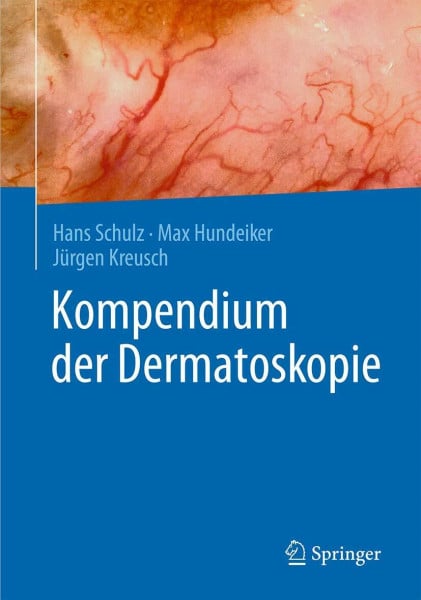 Kreusch, Jürgen Kompendium der Dermatoskopie