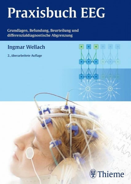 Wellach, Ingmar Praxisbuch EEG: Grundlagen, Befundung, Beurteilung und differenzialdiagnostische Abgrenzung